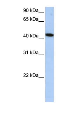 Polyclonal Rabbit anti-Human ALS2CR15 / ICA1L Antibody (C-Terminus, WB)