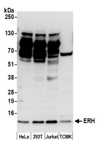 Polyclonal Rabbit anti-Human ERH Antibody (aa54-104, WB)