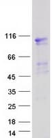 Human EVI5L Protein (Recombinant Myc-DDK (Flag))