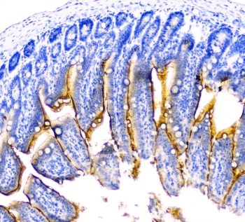 Polyclonal Rabbit anti-Mouse DDR2 Antibody (IHC, WB)