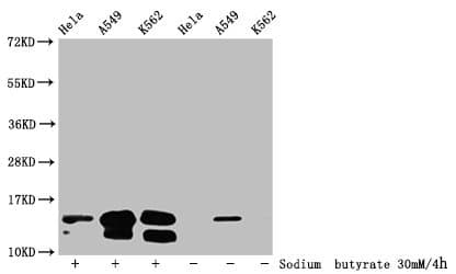 HIST1H2BN Antibody