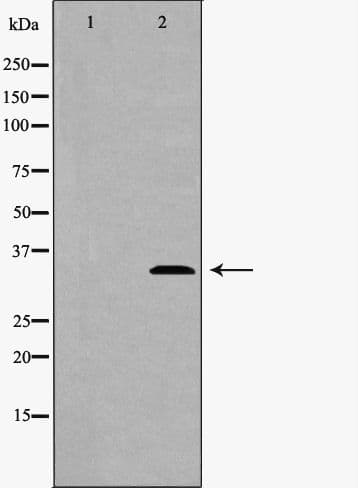 TFPI / LACI Antibody