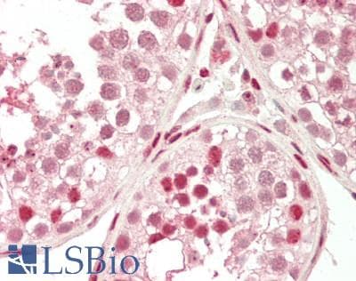 IHC-plus™ SP1 Antibody (aa735-785)