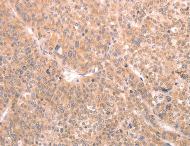 ABCF1 Antibody