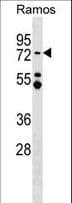 Polyclonal Rabbit anti-Human MTA3 Antibody (aa559-587, WB)