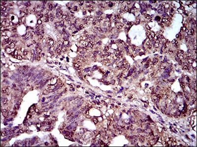 IL2RA / CD25 Antibody (aa34-139, clone 1B5D12)