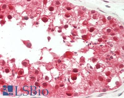 IHC-plus™ CSNK2A2 Antibody