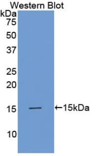 AMH / Anti-Mullerian Hormone Antibody (aa453-560)