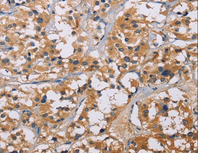 NME5 Antibody