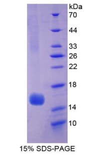 Human HEXB Protein (Recombinant His)