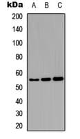 PathPlus™ KRT8 / CK8 / Cytokeratin 8 Antibody (C-Terminus)