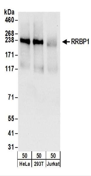 RRBP1 / hES Antibody (aa675-725)