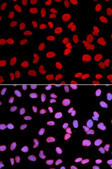 Polyclonal Rabbit anti-Human TMPO / TP / Thymopoietin Antibody (IHC, IF, WB)