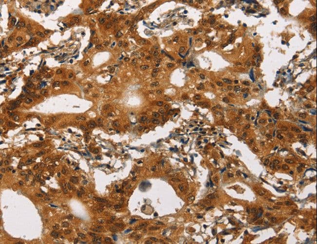 Polyclonal Rabbit anti-Human CACNA1C / Cav1.2 Antibody (IHC)