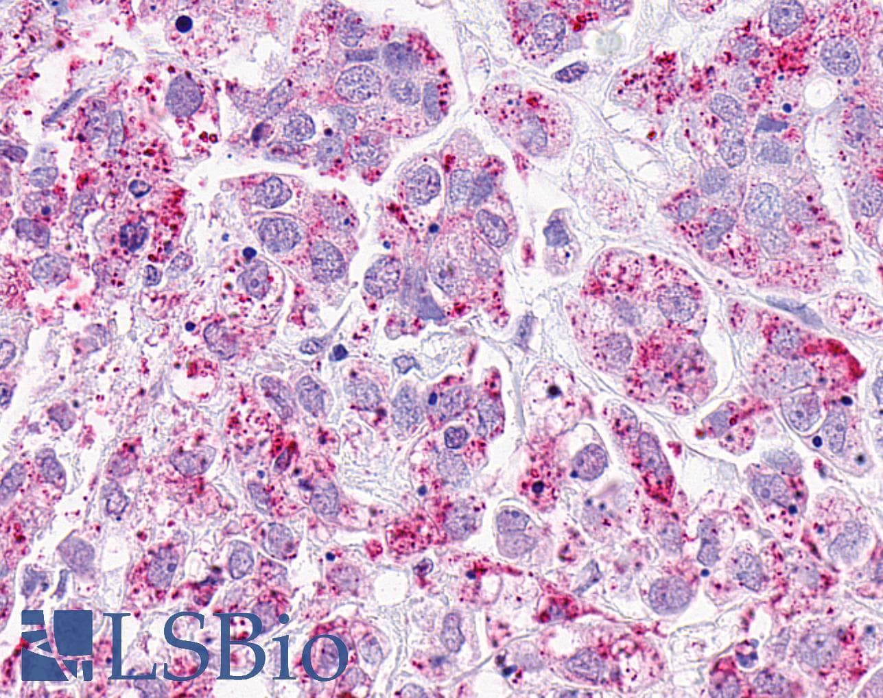 PathPlus™ OXER1 Antibody (C-Terminus)