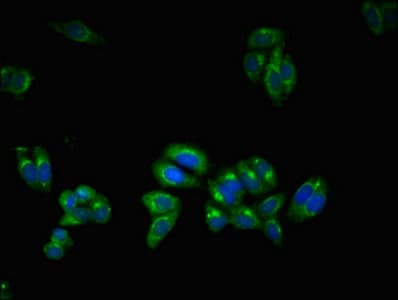 Ubiquilin 2 / UBQLN2 Antibody