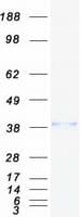 Human ADH5 Protein (Recombinant Myc-DDK (Flag))