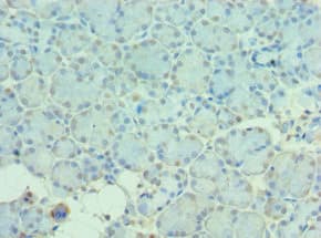 Polyclonal Rabbit anti-Human MTM1 / Myotubularin Antibody (aa484-603, IHC)