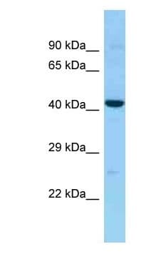 CCR10 / GPR2 Antibody (aa143-192)