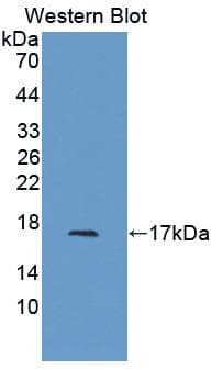 ACTRIIB / ACVR2B Antibody (aa214-350, FITC)