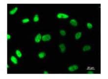 MATR3 / Matrin 3 Antibody