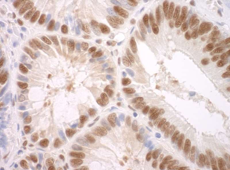 SF3A3 / SF3a60 Antibody (aa451-501)