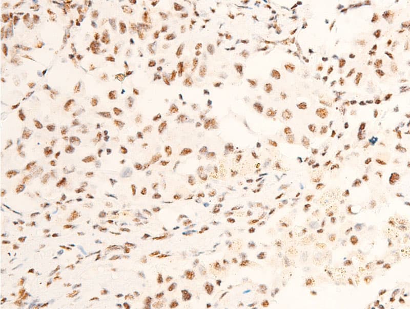 Polyclonal Rabbit anti-Human NTRK1 / TrkA Antibody (phospho-Tyr680,phospho-Tyr681, IHC, WB)