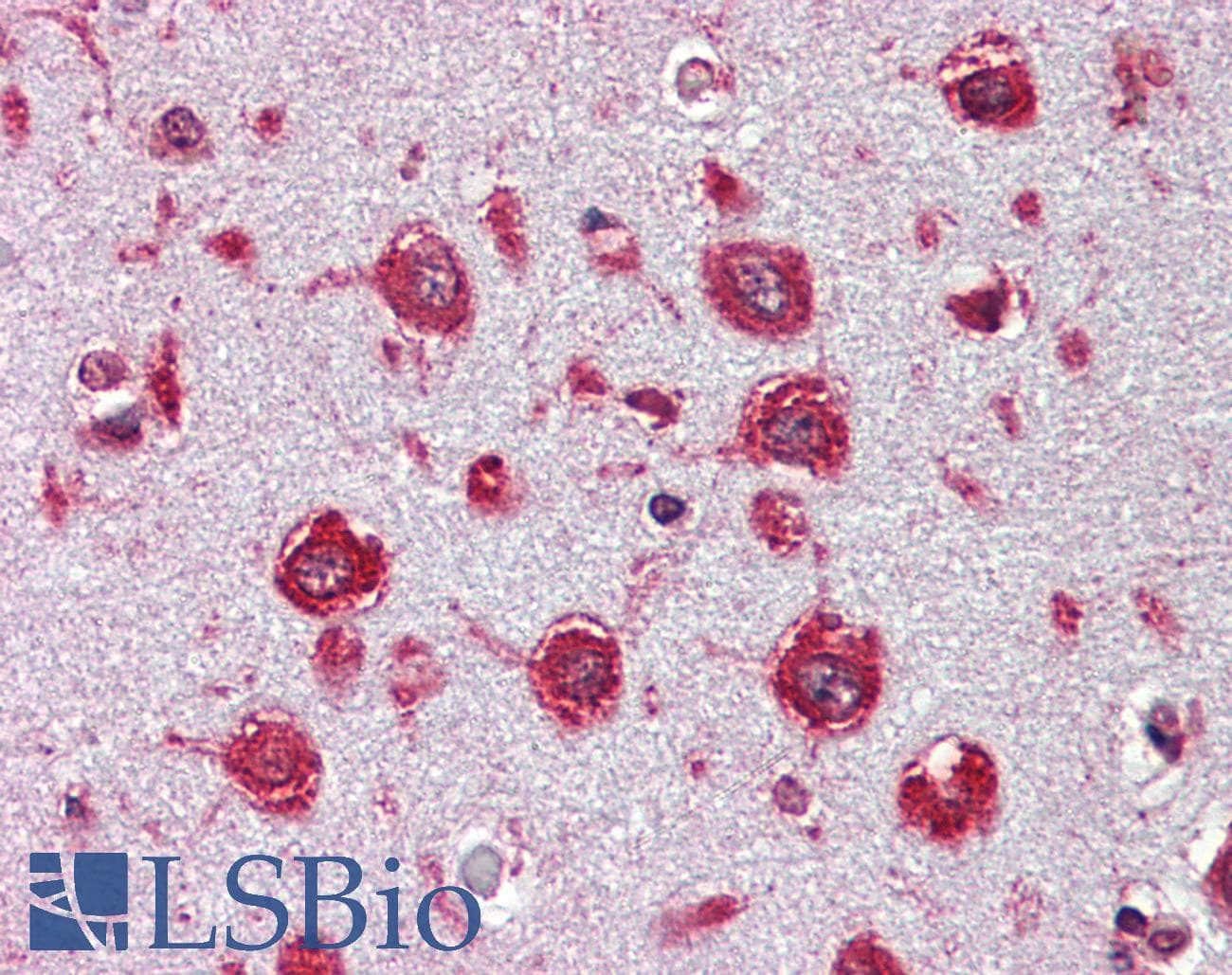 IHC-plus™ Trypsin Antibody (clone TRYP11-224.3)