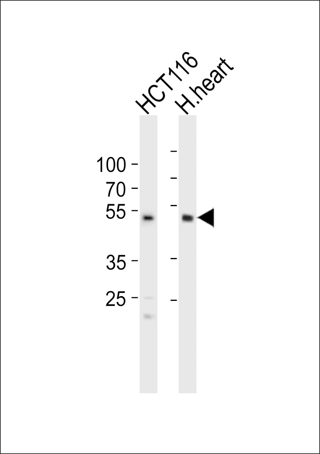 Polyclonal Rabbit anti-Human SOX7 Antibody (aa319-353, WB)