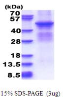 Human PRKACB Protein (Recombinant His)
