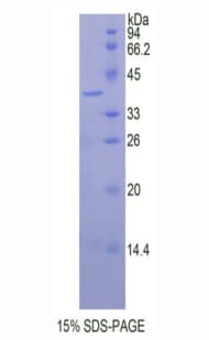 Human HAS1 / HAS Protein (Recombinant His, N-Terminal)