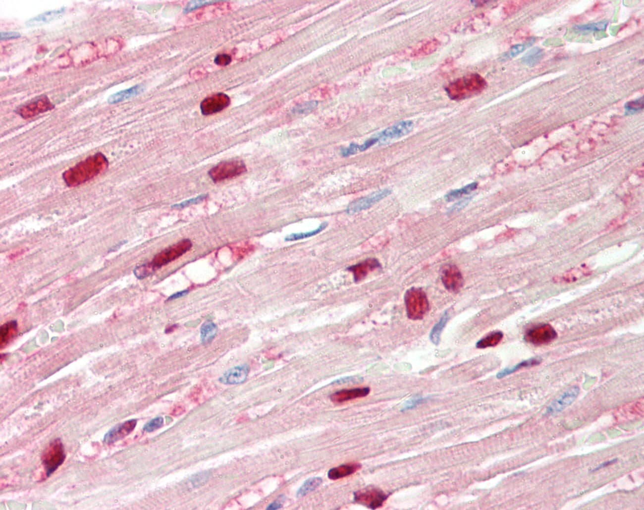 TPI1 / TPI Antibody (N-Terminus)