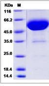 Human CD47 Protein (Recombinant Human IgG Fc, C-terminus)