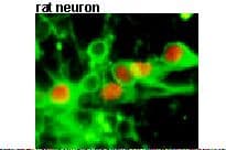 IHC-plus™ Polyclonal Rabbit anti-Human ZFHX3 / ATBF1 Antibody (IHC, IF, WB)