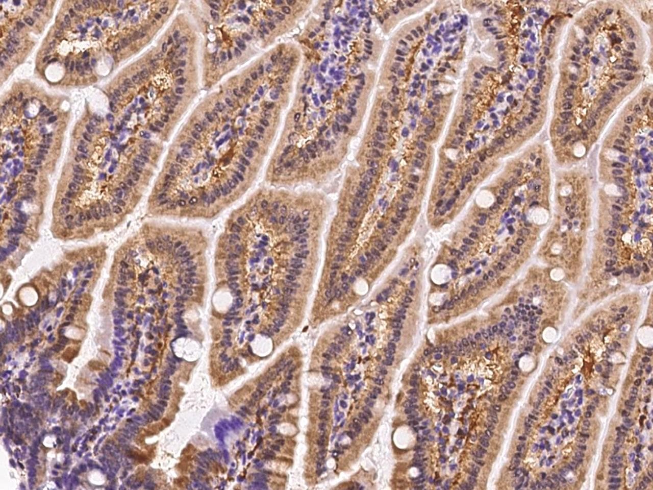 Polyclonal Rabbit anti-Mouse I-BABP / FABP6 Antibody (IHC)