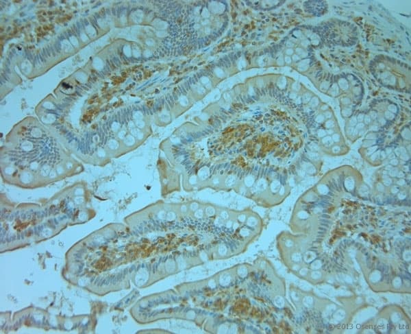 TANK Antibody (aa150-200)