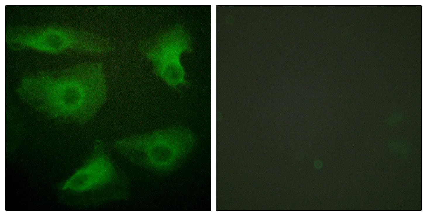 NFKBIE / IKB Epsilon Antibody (phospho-Ser22)