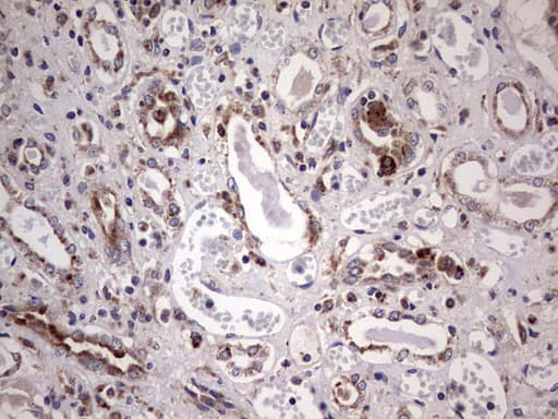 Monoclonal Mouse anti-Human PPP2R5D Antibody (clone OTI5E7, IHC, WB)