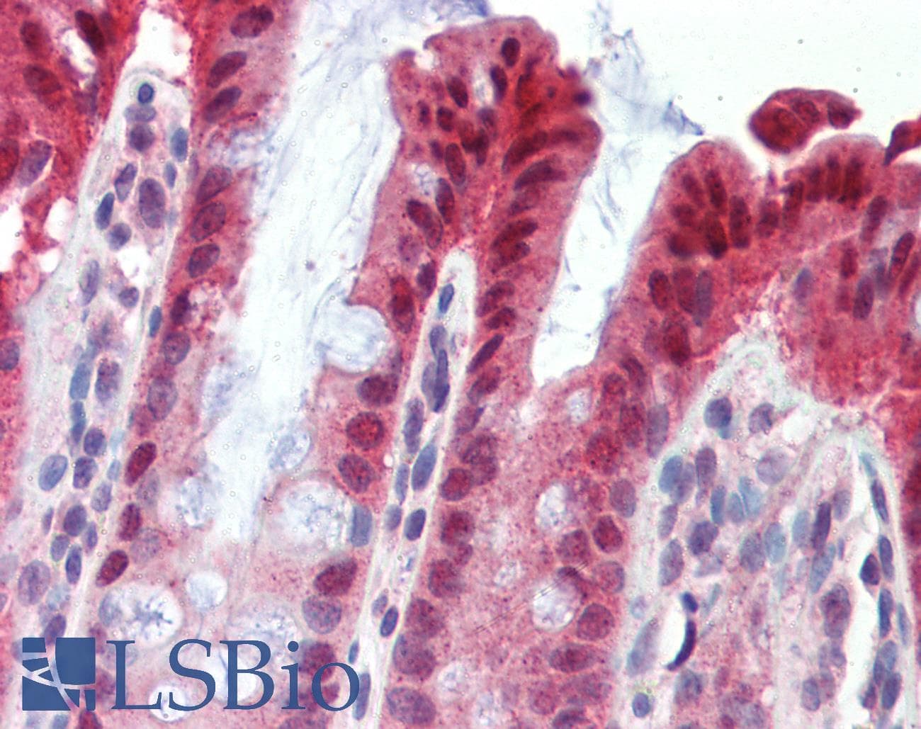 NR1I3 / CAR Antibody (aa180-229)