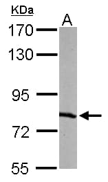 Polyclonal Rabbit anti-Human RPA70 / RPA1 Antibody (aa369-616, IHC, WB)