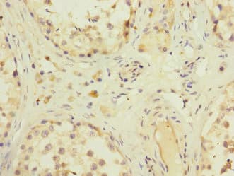 ZFPM2 / FOG2 Antibody