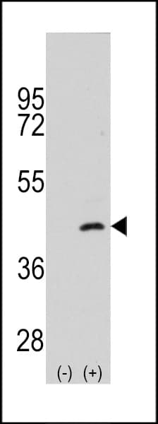 MAP2K4 / MKK4 Antibody (Ser257)