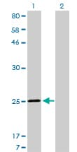 IHC-plus™ Monoclonal Mouse anti-Human TNNI3 / Cardiac Troponin I Antibody (clone 1E7, IHC, IF, WB)