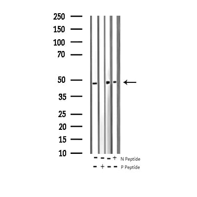 HNRNPC / HNRNP C Antibody (phospho-Ser260)