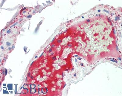 Complement C5a Antibody (aa678-751)