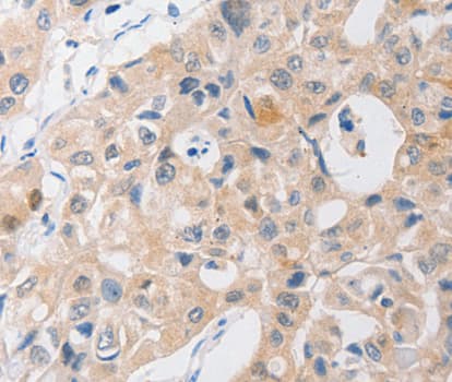 P2RY11 / P2Y11 Antibody
