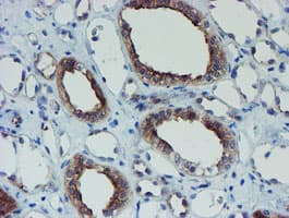 Monoclonal Mouse anti-Human SENP2 Antibody (clone OTI6F1, IHC, IF, WB)