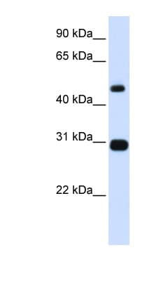 Polyclonal Rabbit anti-Human PSMC3 Antibody (aa101-134, WB)