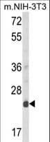 IHC-plus™ DERL1 / Derlin 1 Antibody (aa224-251)