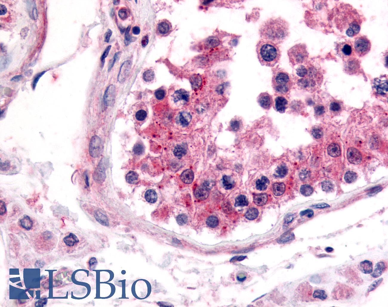 IHC-plus™ NRF1 / NRF-1 Antibody